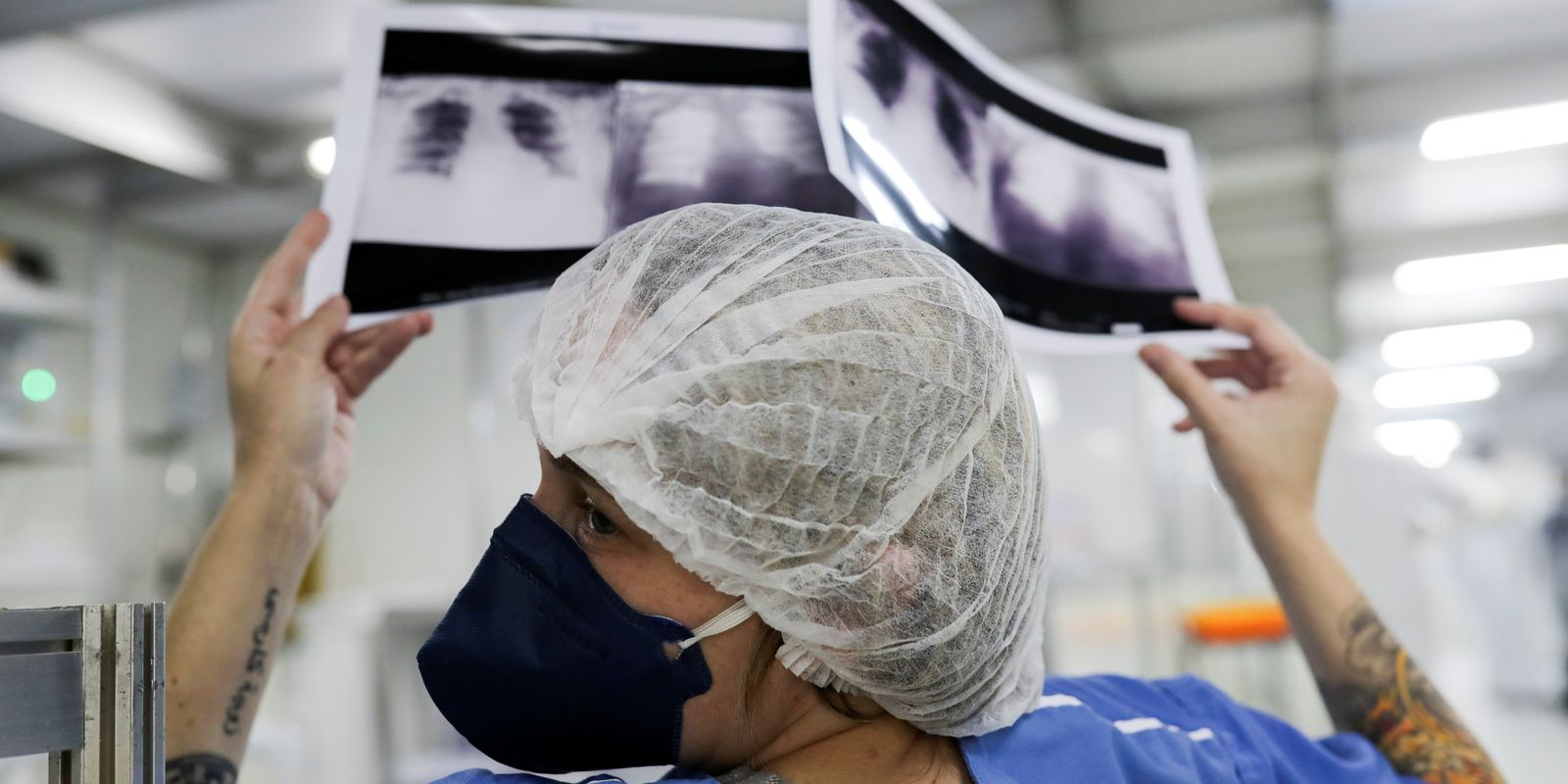 Câncer de pulmão: 15% dos casos acontecem em não fumantes