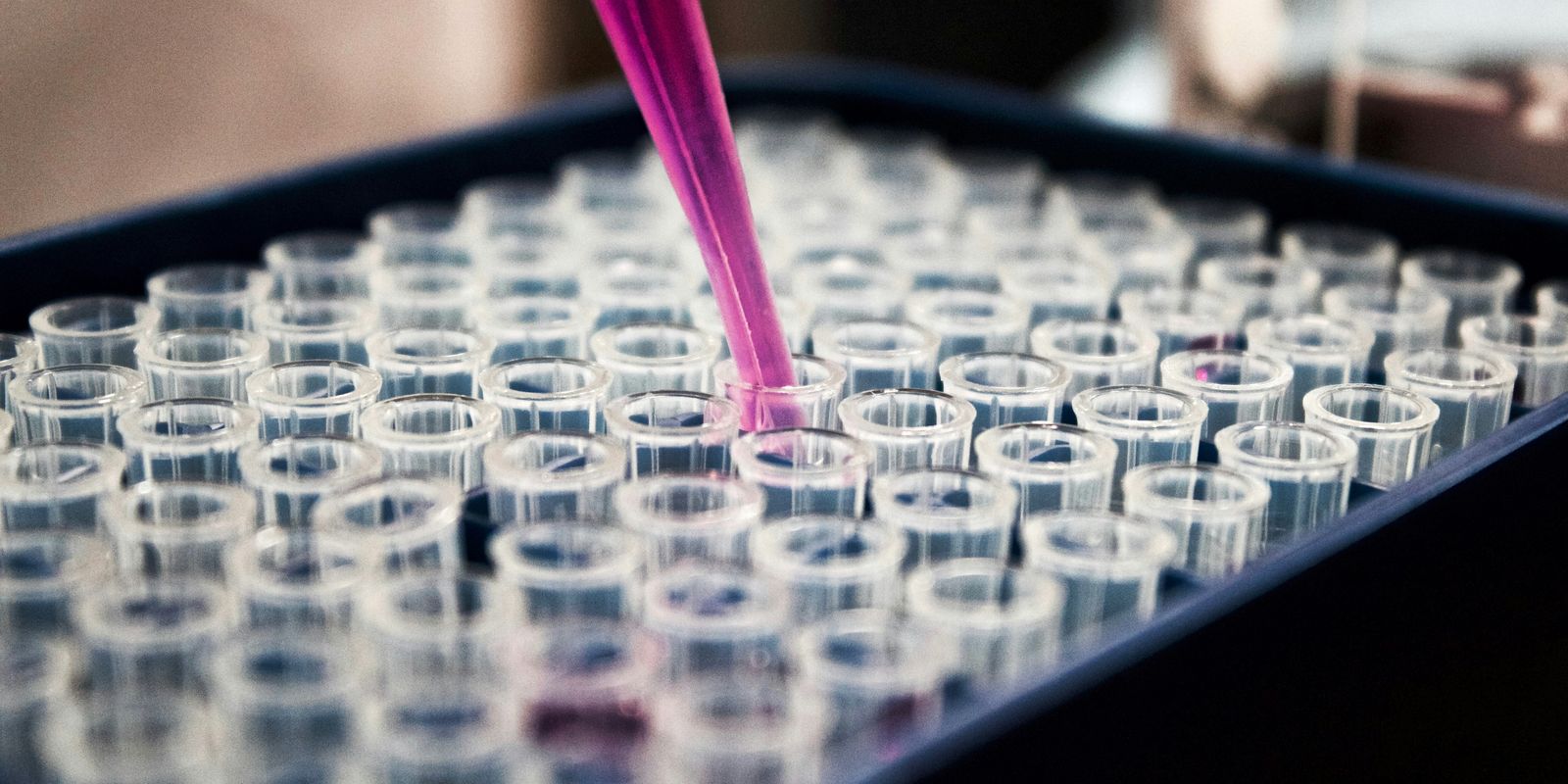 Estudo mostra que inflamação no cérebro pode ser chave do Alzheimer