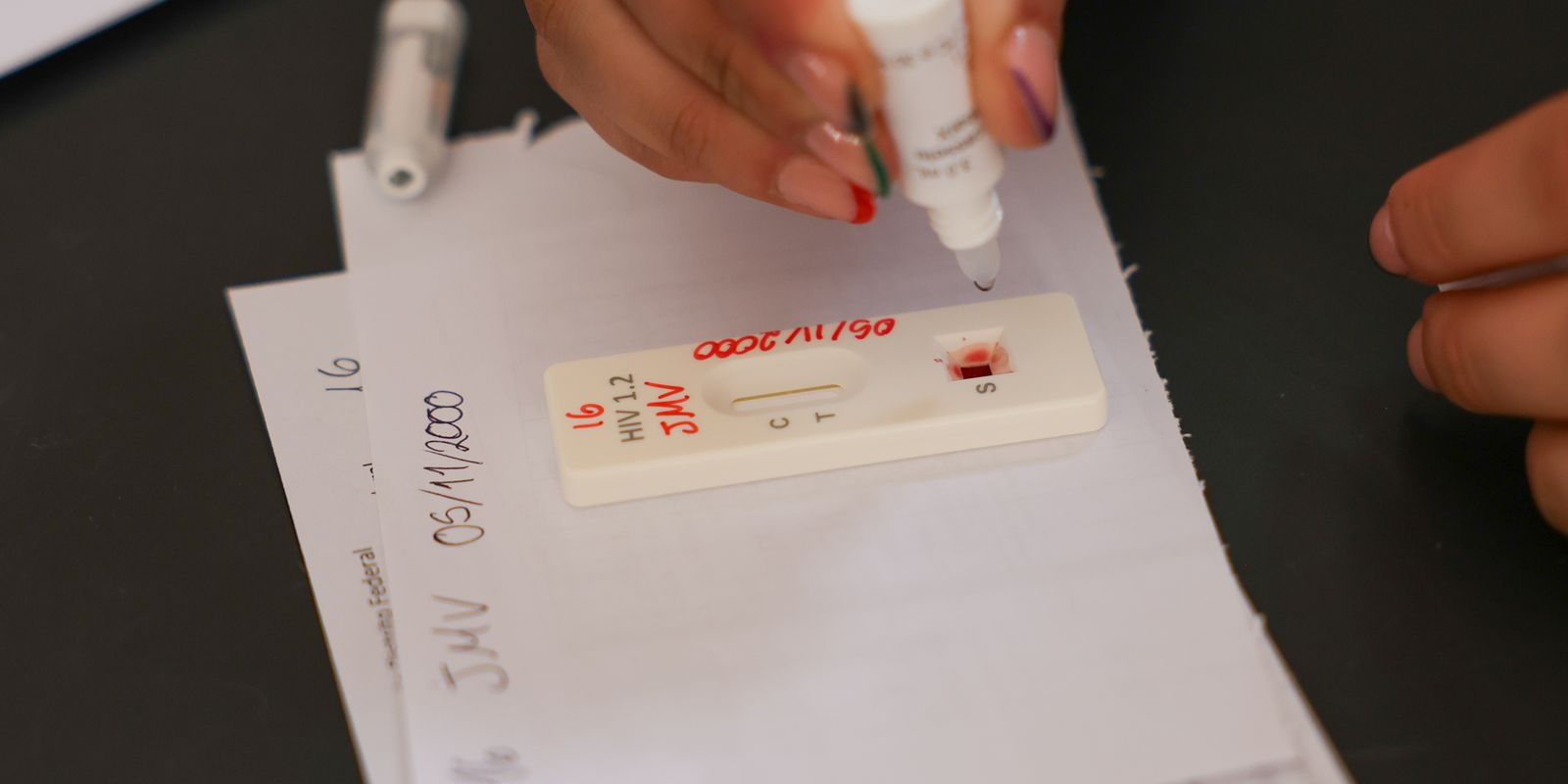 Brasil celebra avanços neste Dia Mundial de Luta contra o HIV