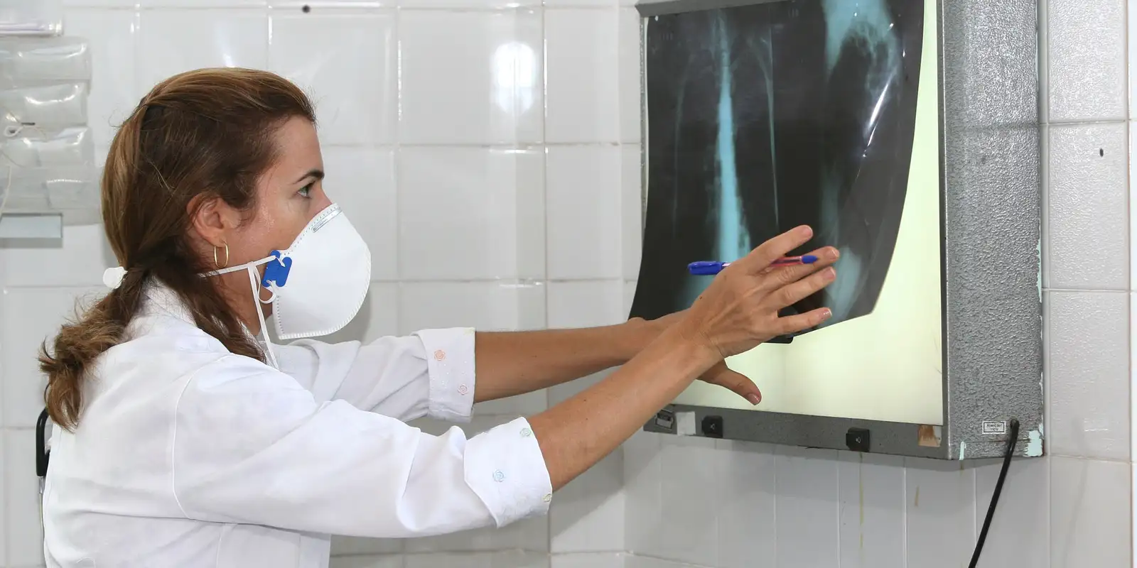 OMS recomenda testes de diagnóstico rápido para erradicar tuberculose