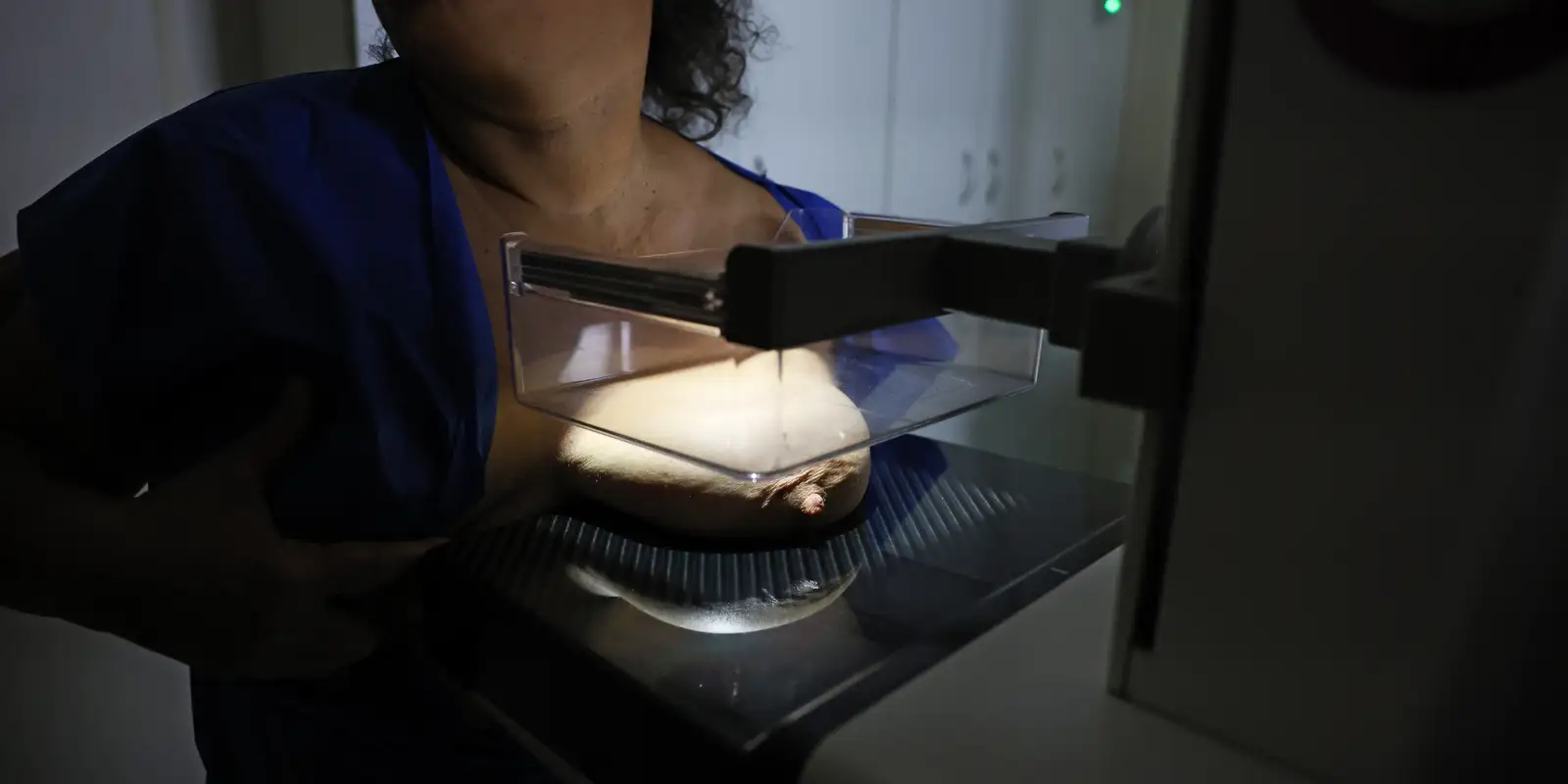 ANS defende que plano cubra mamografia digital sem restrição de idade